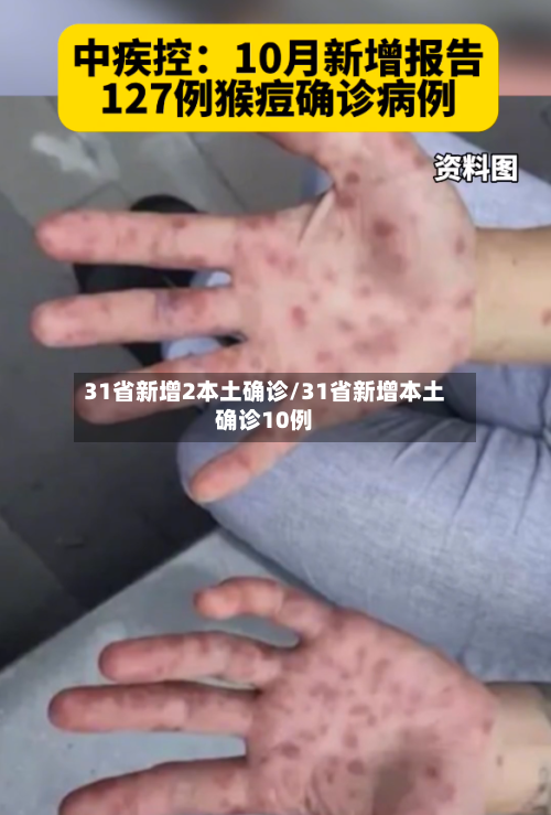 31省新增2本土确诊/31省新增本土确诊10例-第2张图片