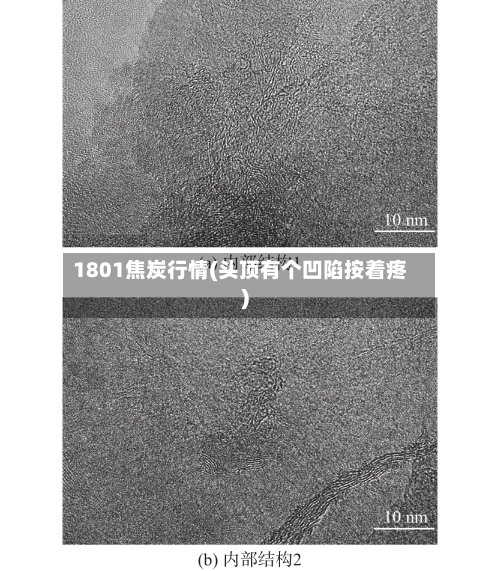 1801焦炭行情(头顶有个凹陷按着疼)