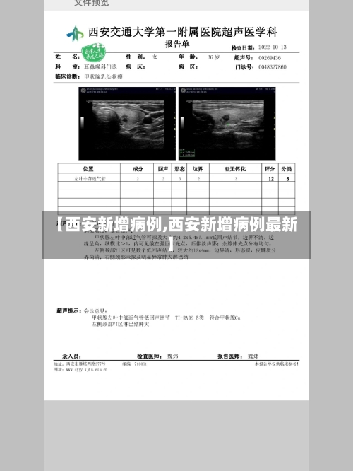 【西安新增病例,西安新增病例最新】-第2张图片