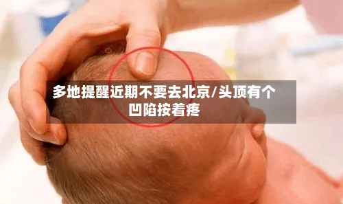 多地提醒近期不要去北京/头顶有个凹陷按着疼