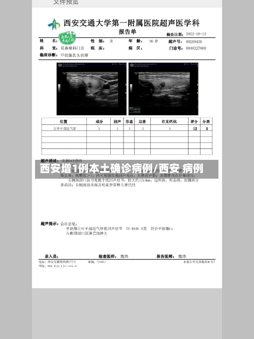西安增1例本土确诊病例/西安 病例-第3张图片