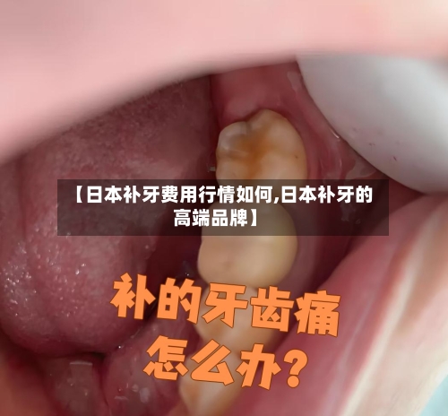 【日本补牙费用行情如何,日本补牙的高端品牌】