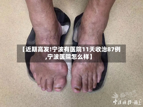 【近期高发!宁波有医院11天收治87例,宁波医院怎么样】-第2张图片