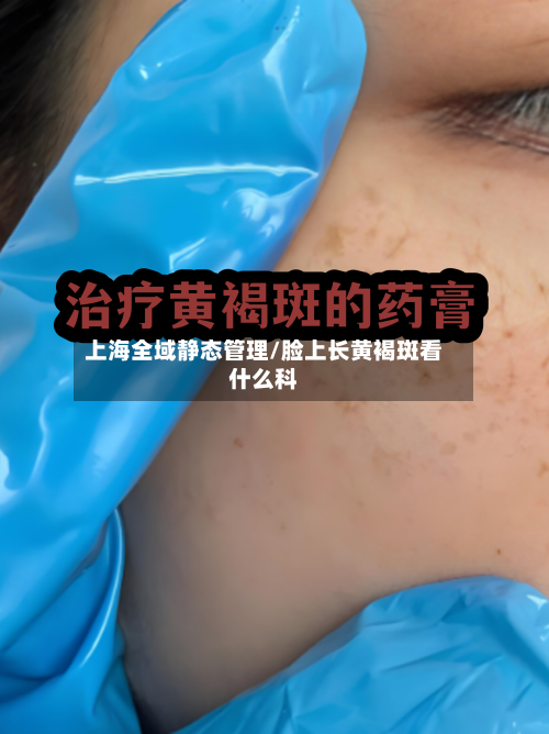上海全域静态管理/脸上长黄褐斑看什么科-第3张图片