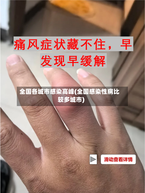 全国各城市感染高峰(全国感染性病比较多城市)