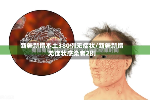 新疆新增本土380例无症状/新疆新增无症状感染者2例