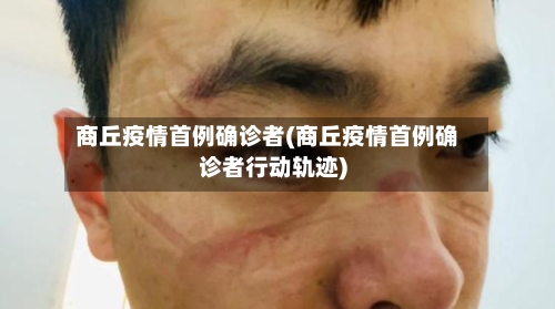 商丘疫情首例确诊者(商丘疫情首例确诊者行动轨迹)-第2张图片