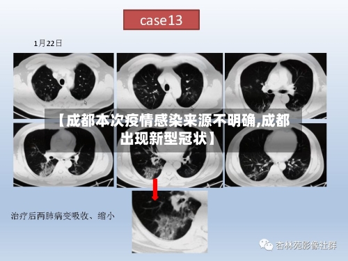 【成都本次疫情感染来源不明确,成都出现新型冠状】