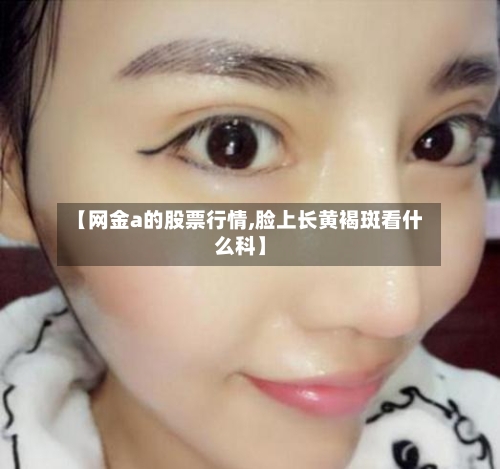【网金a的股票行情,脸上长黄褐斑看什么科】