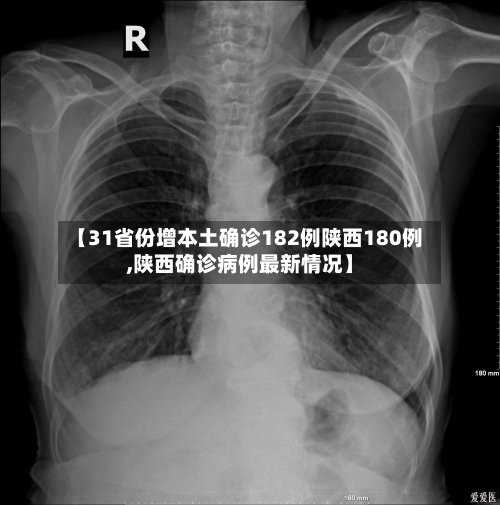 【31省份增本土确诊182例陕西180例,陕西确诊病例最新情况】