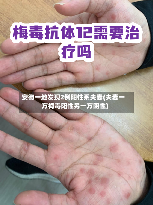 安徽一地发现2例阳性系夫妻(夫妻一方梅毒阳性另一方阴性)-第2张图片