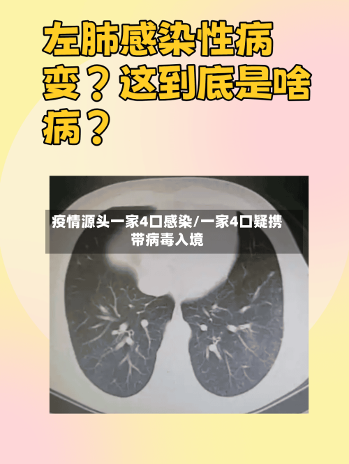 疫情源头一家4口感染/一家4口疑携带病毒入境-第3张图片