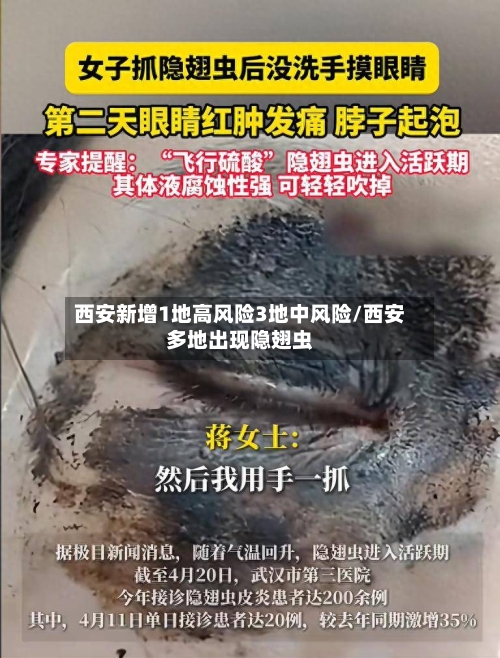 西安新增1地高风险3地中风险/西安多地出现隐翅虫