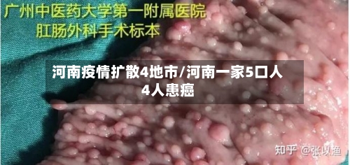 河南疫情扩散4地市/河南一家5口人4人患癌-第2张图片