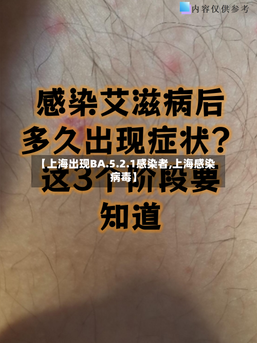 【上海出现BA.5.2.1感染者,上海感染病毒】-第3张图片