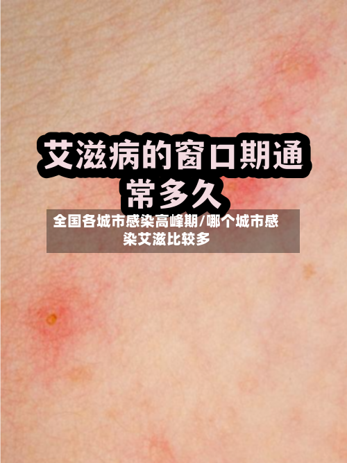 全国各城市感染高峰期/哪个城市感染艾滋比较多