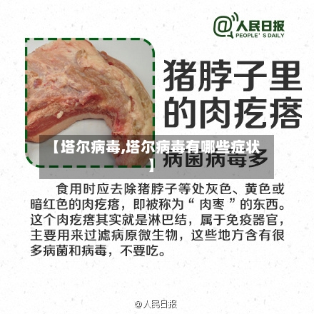【塔尔病毒,塔尔病毒有哪些症状】-第2张图片