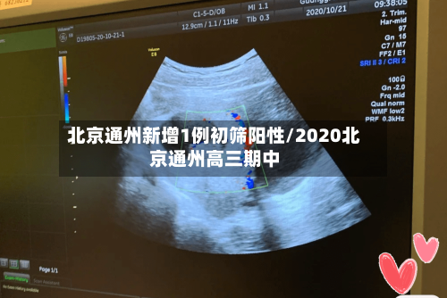 北京通州新增1例初筛阳性/2020北京通州高三期中
