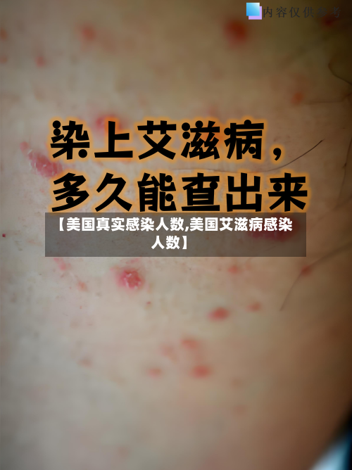 【美国真实感染人数,美国艾滋病感染人数】