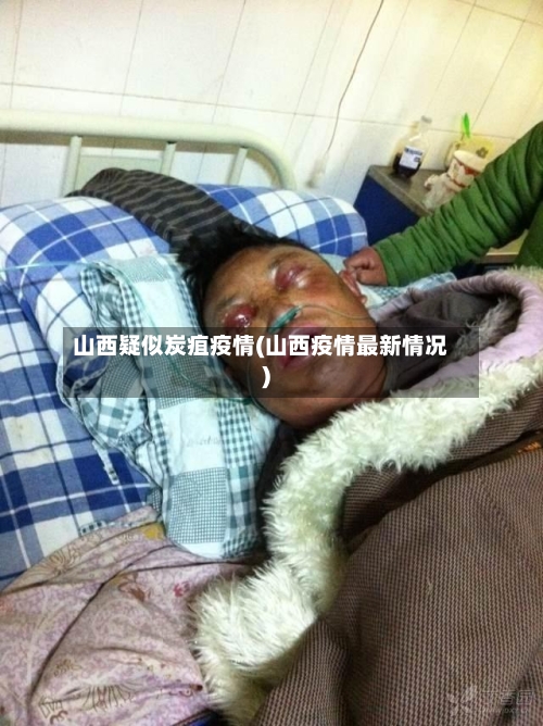 山西疑似炭疽疫情(山西疫情最新情况)-第2张图片